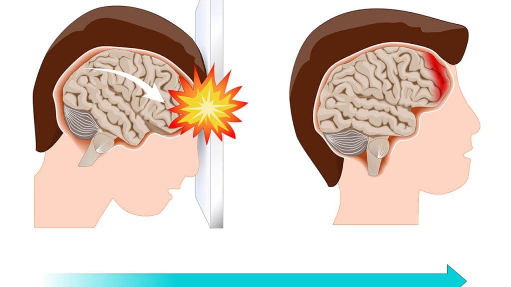 What are some of the symptoms of a head injury?
